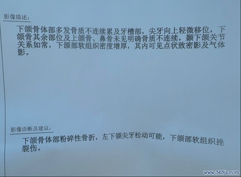 李先生公开的影像会诊书